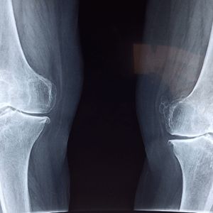 Shibarium Network Lull – How It Affects The Future Of BONE