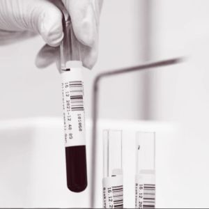 This promising anti-aging drugs just failed its human test