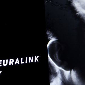 Second Neuralink Patient Does 3D Design and Plays CounterStrike With His Brain